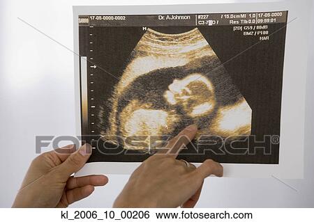 Woman pointing at sonogram View Large Photo Image Stock Photograph - Woman pointing at sonogram. Fotosearch