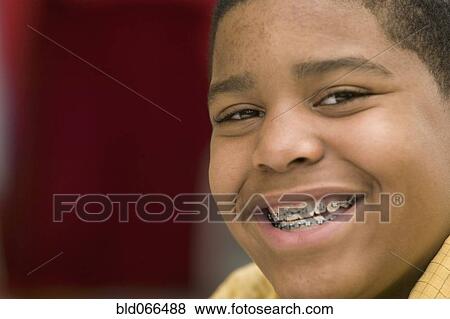 Stock Photo - Portrait of African boy with braces. Fotosearch