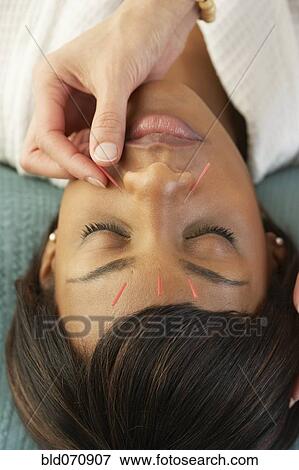 Acupuncture needles in African woman's face View Large Photo Image Stock Photo - Acupuncture needles in African woman's face. Fotosearch