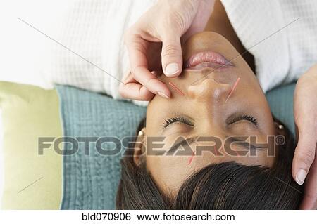 Acupuncture needles in African woman's face View Large Photo Image Stock Photograph - Acupuncture needles in African woman's face. Fotosearch