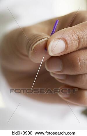 Stock Image - Close up of Acupuncture needle. Fotosearch