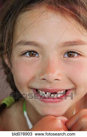 Mixed race girl with tooth missing View Large Photo Image Stock Image - Mixed race girl with tooth missing. Fotosearch