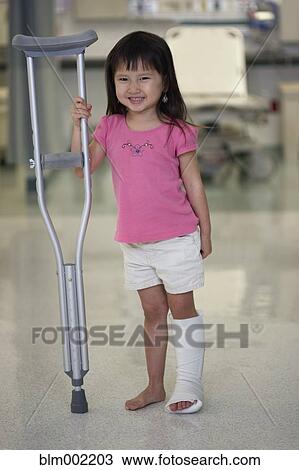 Asian girl with leg in cast View Large Photo Image Stock Image - Asian girl with leg in cast. Fotosearch
