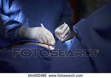 Stock Photograph - Close up of doctor performing surgery. Fotosearch