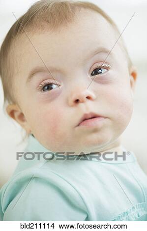 Caucasian baby girl with Down Syndrome View Large Photo Image Picture - Caucasian baby girl with Down Syndrome. Fotosearch