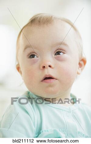 Caucasian baby girl with Down Syndrome View Large Photo Image Stock Image - Caucasian baby girl with Down Syndrome. Fotosearch