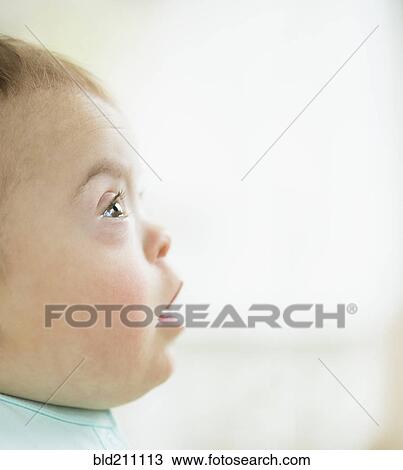 Stock Image - Caucasian baby girl with Down Syndrome. Fotosearch