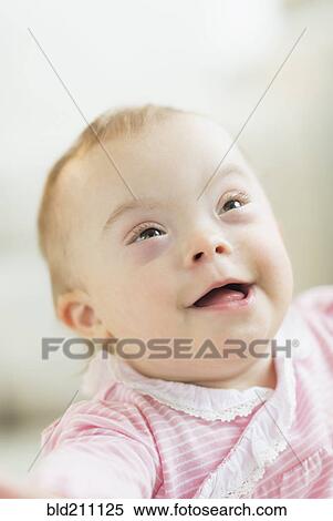 Caucasian baby girl with Down Syndrome View Large Photo Image Stock Photography - Caucasian baby girl with Down Syndrome. Fotosearch