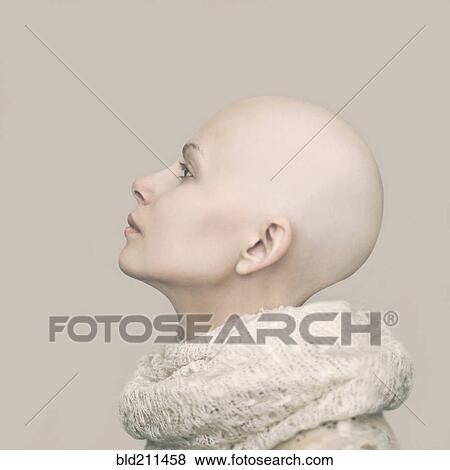 Stock Photo - Caucasian woman with bald head. Fotosearch