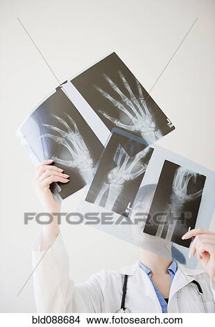 Picture - Korean doctor looking at x-rays of hand bones. Fotosearch