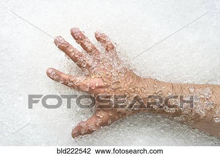 Stock Image - Arm of man on ice. Fotosearch