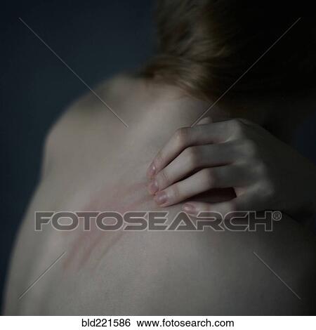 Stock Photograph - Caucasian teenage girl scratching her shoulder. Fotosearch