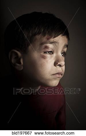 Stock Photo - Mixed race boy with scrapes on his face. Fotosearch