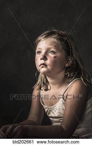 Stock Image - Sad Caucasian girl with scratches on her face. Fotosearch