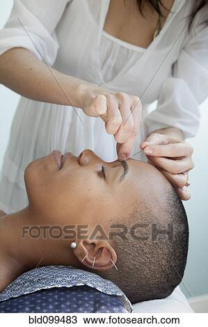 Black woman receiving acupuncture treatments View Large Photo Image Stock Image - Black woman receiving acupuncture treatments. Fotosearch