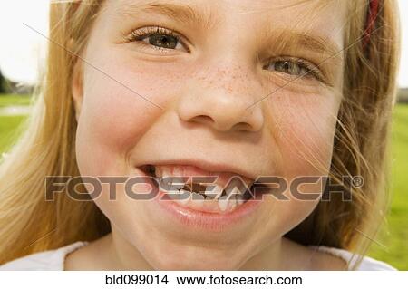 Picture - Grinning girl with tooth missing. Fotosearch