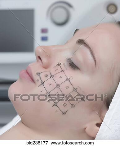 Medical diagram on check of Caucasian woman View Large Photo Image Stock Photo - Medical diagram on check of Caucasian woman. Fotosearch