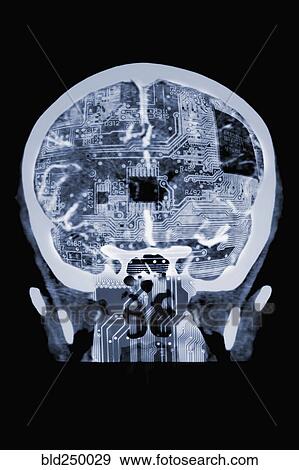 Stock Photo - Circuit board in x-ray of skull. Fotosearch