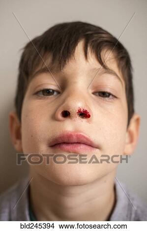 Portrait of Mixed Race boy with bloody nose View Large Photo Image Picture - Portrait of Mixed Race boy with bloody nose. Fotosearch