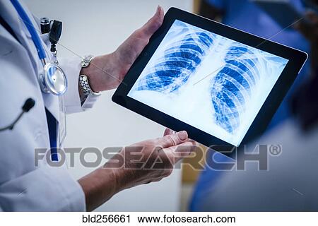 Stock Image - Doctors examining x-ray of chest and ribs on digital tablet. Fotosearch