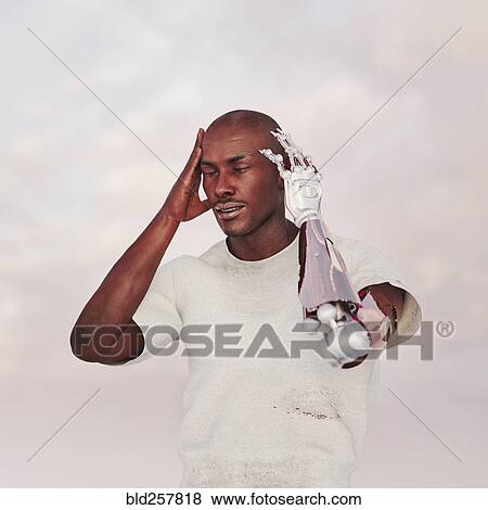 Stock Photo - Frustrated man with 1osthetic arm. Fotosearch