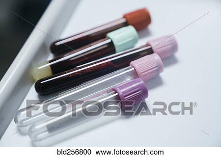 Test tubes with caps on table View Large Photo Image Stock Image - Test tubes with caps on table. Fotosearch