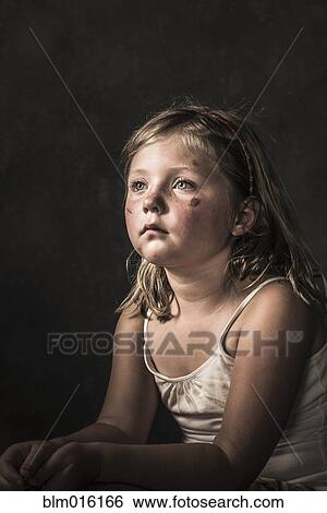 Sad Caucasian girl with scratches on her face View Large Photo Image Stock Photograph - Sad Caucasian girl with scratches on her face. Fotosearch