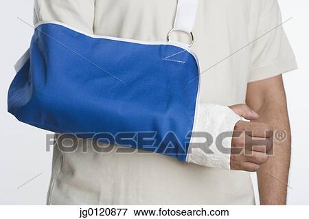 Stock Photo - Close up of man's arm in sling. Fotosearch