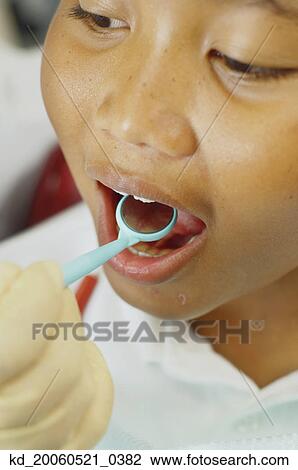 Close up of dentist's hand holding dental mirror in boy's mouth View Large Photo Image Stock Image - Close up of dentist's hand holding dental mirror in boy's mouth. Fotosearch