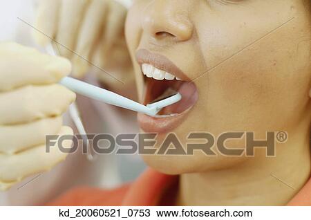 Dentist holding dental mirror in female patient's mouth View Large Photo Image Stock Image - Dentist holding dental mirror in female patient's mouth. Fotosearch