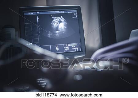 Picture - Pregnant woman having sonogram. Fotosearch