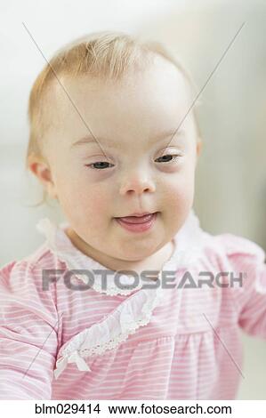 Caucasian baby girl with Down Syndrome View Large Photo Image Picture - Caucasian baby girl with Down Syndrome. Fotosearch