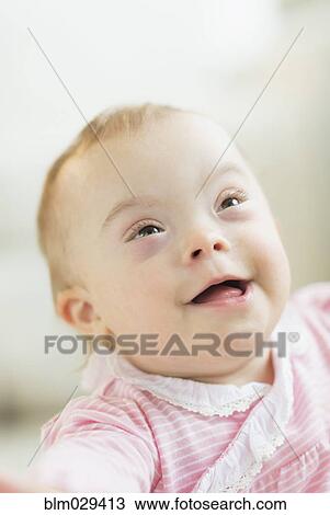 Stock Image - Caucasian baby girl with Down Syndrome. Fotosearch