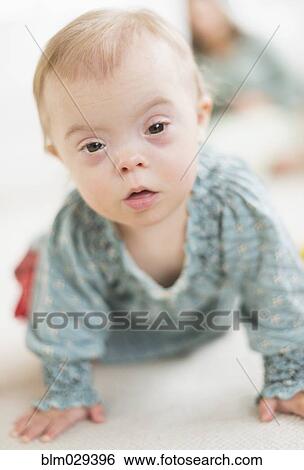 Caucasian baby girl with Down Syndrome crawling View Large Photo Image Stock Photograph - Caucasian baby girl with Down Syndrome crawling. Fotosearch