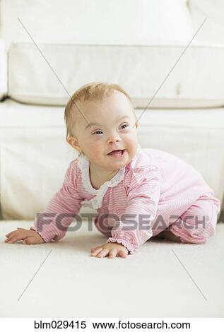 Stock Photography - Caucasian baby girl with Down Syndrome. Fotosearch
