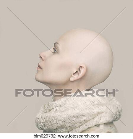 Caucasian woman with bald head View Large Photo Image Stock Image - Caucasian woman with bald head. Fotosearch