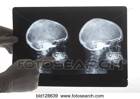 Doctor examining x-rays in hospital View Large Photo Image Stock Photo - Doctor examining x-rays in hospital. Fotosearch