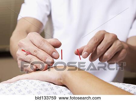Acupuncturist working on patient View Large Photo Image Stock Photo - Acupuncturist working on patient. Fotosearch