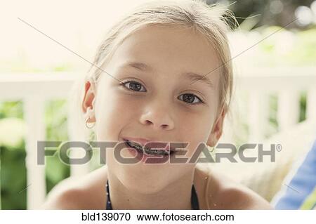 Stock Image - Caucasian girl smiling with braces. Fotosearch