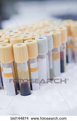 Picture - Close up of blood samples in test tube rack in laboratory. Fotosearch