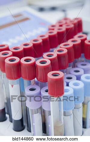 Stock Image - Close up of blood samples in test tube rack in laboratory. Fotosearch