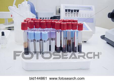 Stock Image - Close up of blood samples in test tube rack in laboratory. Fotosearch