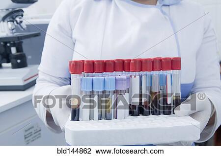 Stock Image - Hispanic scientist holding blood samples in test tube rack in laboratory. Fotosearch