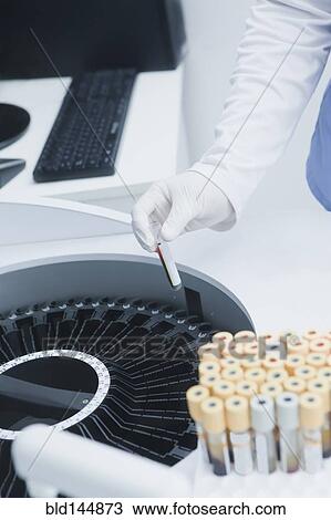Hispanic scientist testing blood sample in laboratory centrifuge View Large Photo Image Stock Image - Hispanic scientist testing blood sample in laboratory centrifuge. Fotosearch