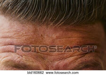 Close up of wrinkled forehead of Caucasian man View Large Photo Image Stock Image - Close up of wrinkled forehead of Caucasian man. Fotosearch