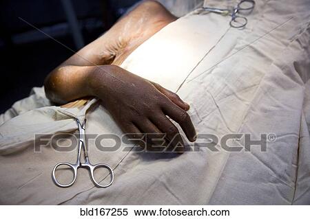Close up of patient laying in surgery View Large Photo Image Stock Photography - Close up of patient laying in surgery. Fotosearch