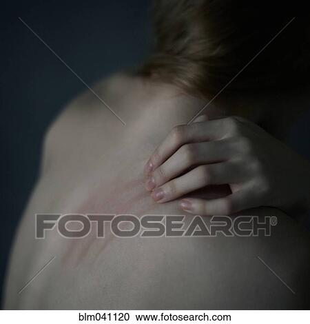 Caucasian teenage girl scratching her shoulder View Large Photo Image Stock Image - Caucasian teenage girl scratching her shoulder. Fotosearch
