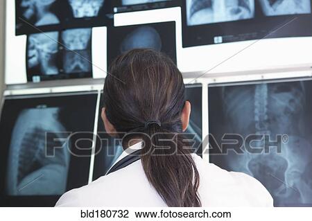 Stock Image - Hispanic doctor examining x-rays in hospital. Fotosearch