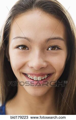 Mixed race girl smiling with braces View Large Photo Image Stock Image - Mixed race girl smiling with braces. Fotosearch
