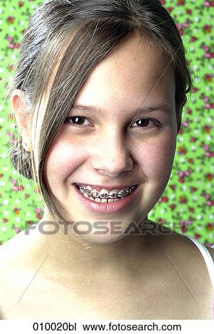 close-up portrait of young teenage girl smiling with braces View Large Photo Image Stock Image - close-up portrait of young teenage girl smiling with braces. Fotosearch